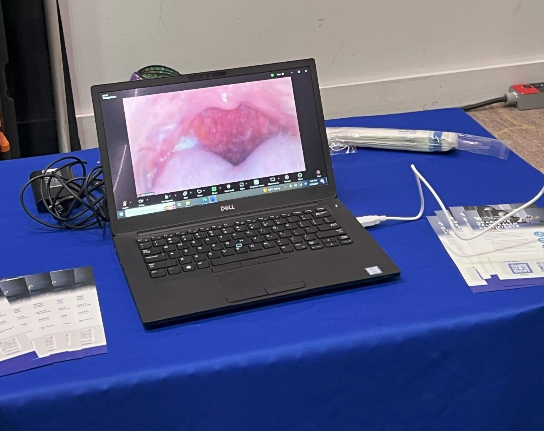 CSD Telehealth Dental Camera