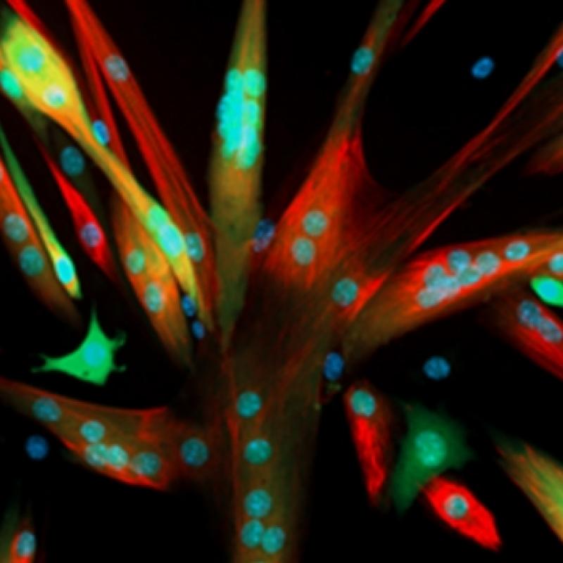 Culture-Grown Muscle Stem Cells