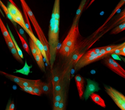 Culture-Grown Muscle Stem Cells