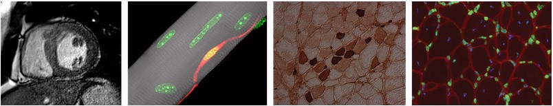 Muscle Cells